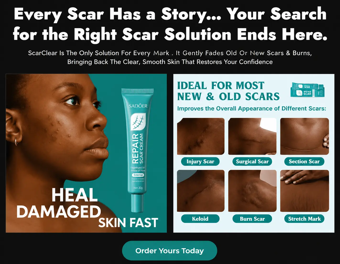 I recommend 3 Case Study Cards.