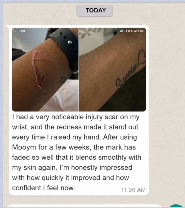Whataspp review mooym